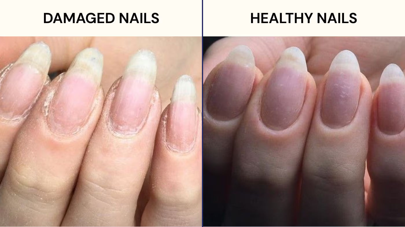 A New Era: EU Bans TPO in Gel Nail Products